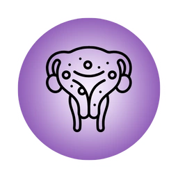 Adenomyosis Treatment in Hyderabad